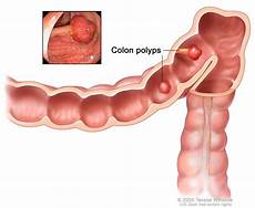 Pulses For Kidney Patients