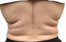 Pulses For Weight Loss